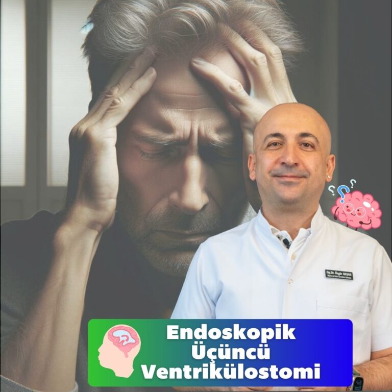 Endoskopik Üçüncü Ventrikülostomi Nedir?