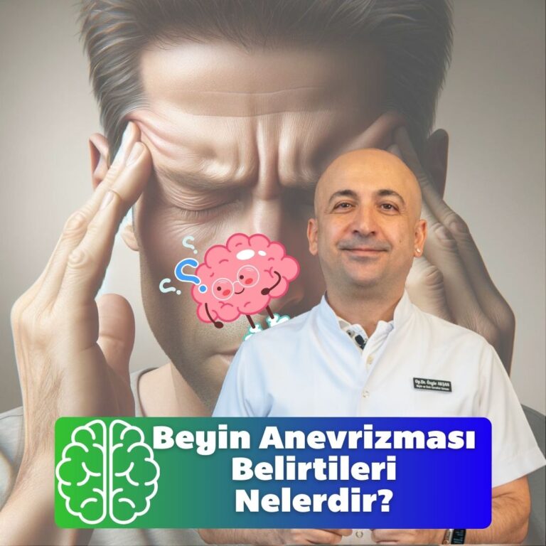 Beyin Anevrizması Belirtileri Nelerdir?